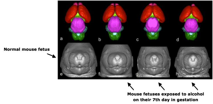 These MRI pictures show that the changes in the faces of the alcohol-exposed mouse fetuses are similar to humans. They have a small nose, nostrils that are too close to each other, an elongated line from the nose to mouth), and a lack of groove in the upper lip.
