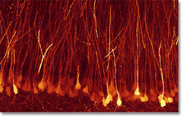 The photo shows neurons in the hippocampus that participate in memory formation. When drugs like alcohol are present, chloride ions move inside these neurons (fluorescing yellow), leading to memory loss.