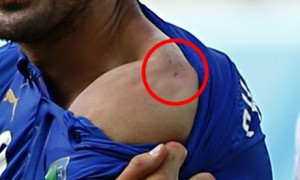 Italy's Giorgio Chiellini after he was bitten by Luis Suarez.