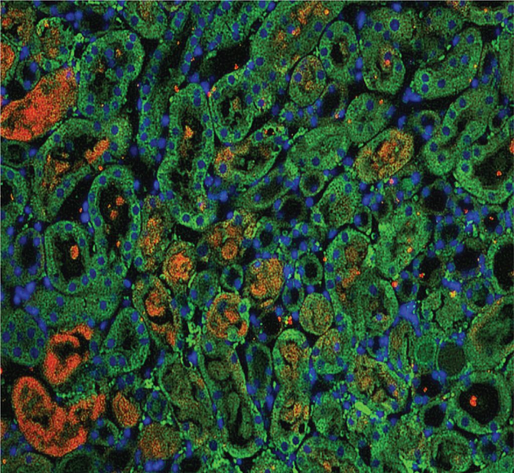 Privratsky Laboratory Metabolic Function in AKI