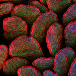 Microbial regulation of intestinal epithelial gene transcription