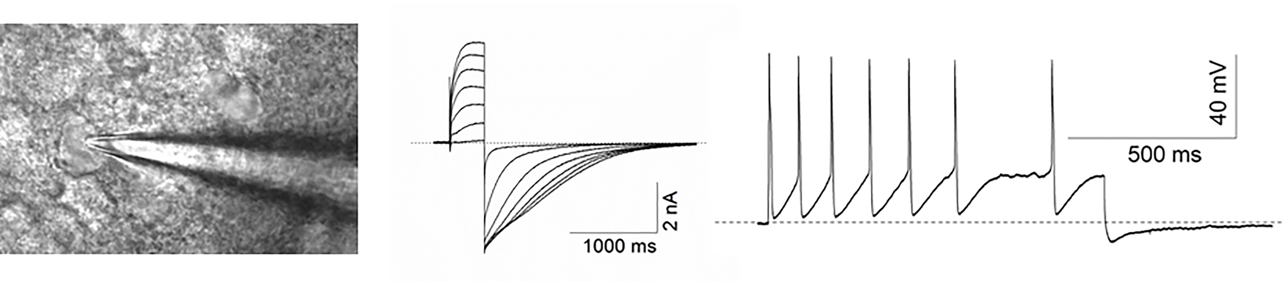 Ephys